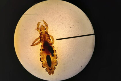 Madrid airport bug scare: Lice, bedbugs and biting panic — but outbreak unconfirmed