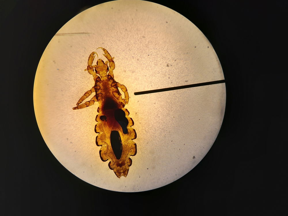Madrid airport bug scare: Lice, bedbugs and biting panic — but outbreak unconfirmed